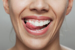 woman smiling with clean teeth