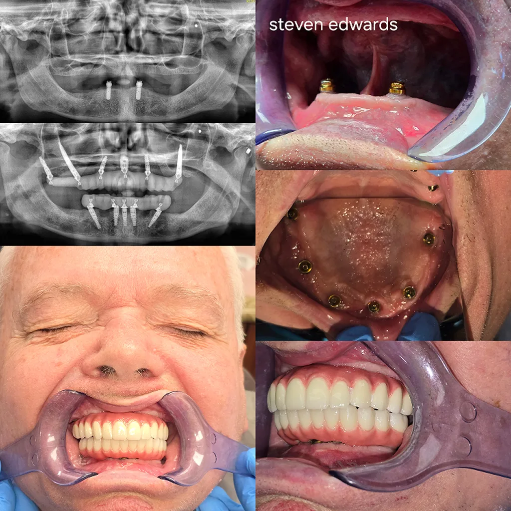 before-after-image-eight