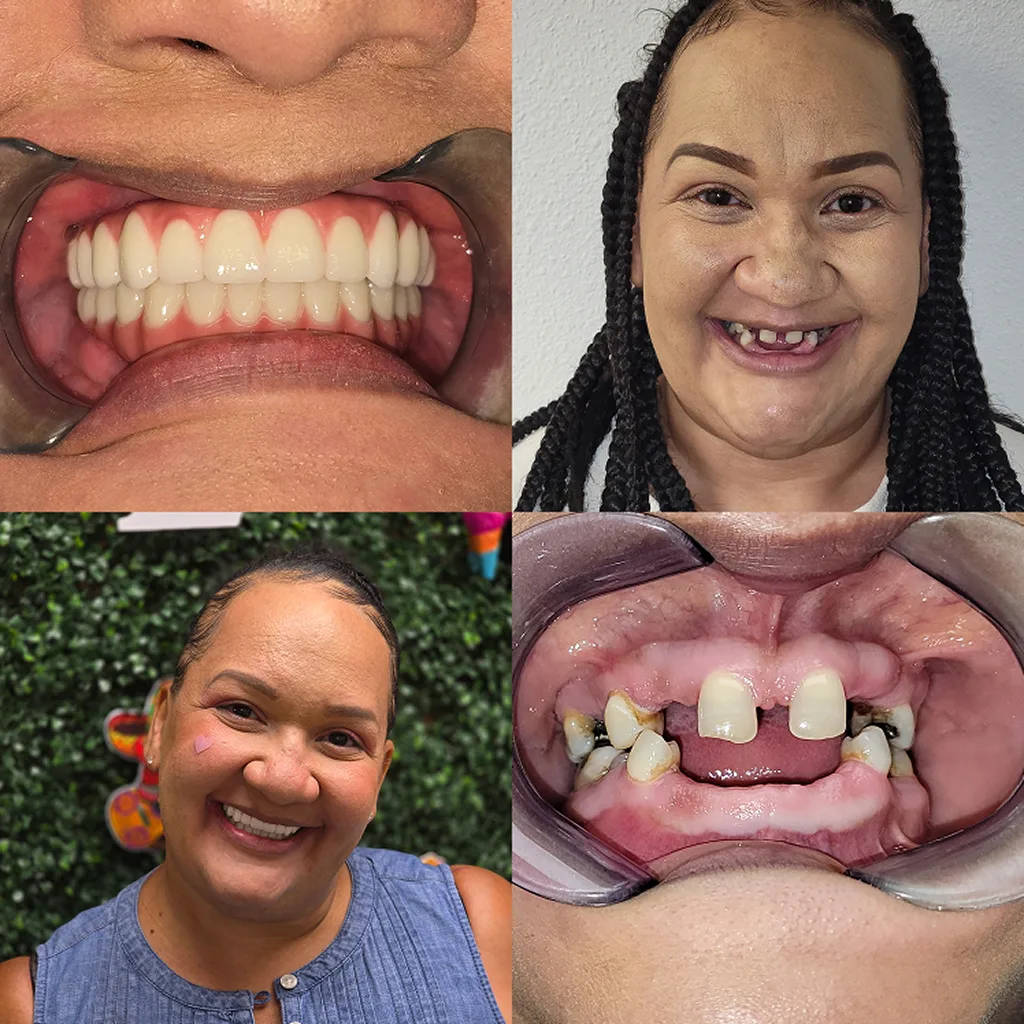 before-after-image-four