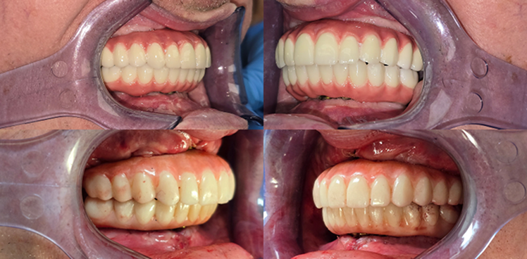 before-after-image-nine