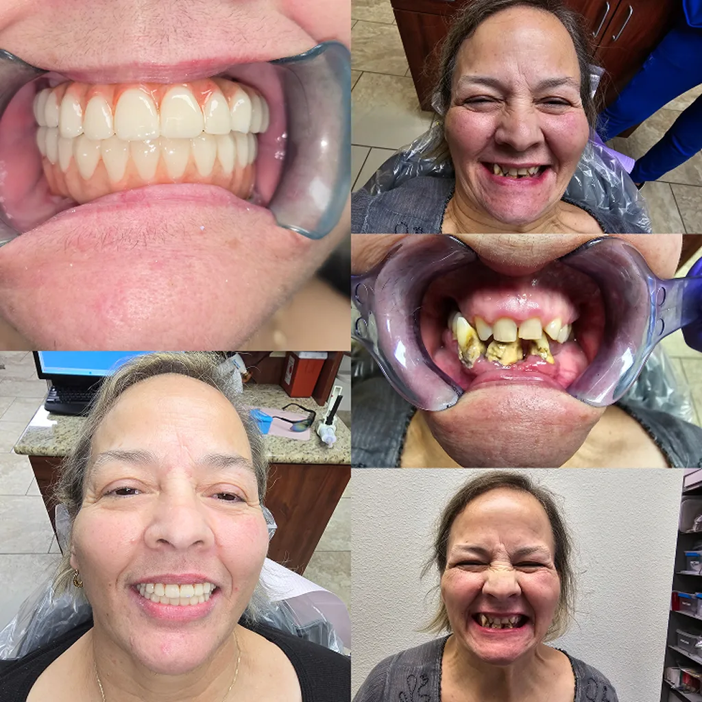 before-after-image-one