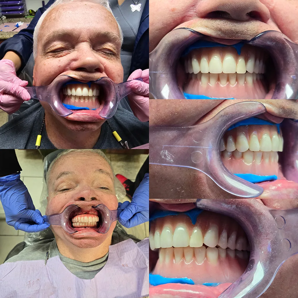 before-after-image-seven