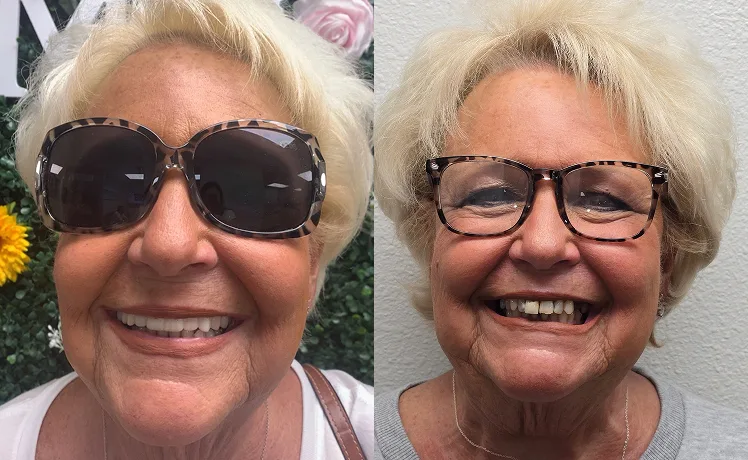 before-after-image-six