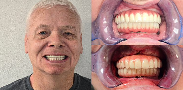 before-after-image-ten