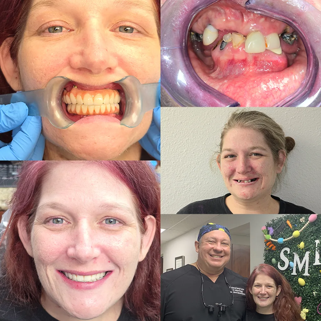 before-after-image-three