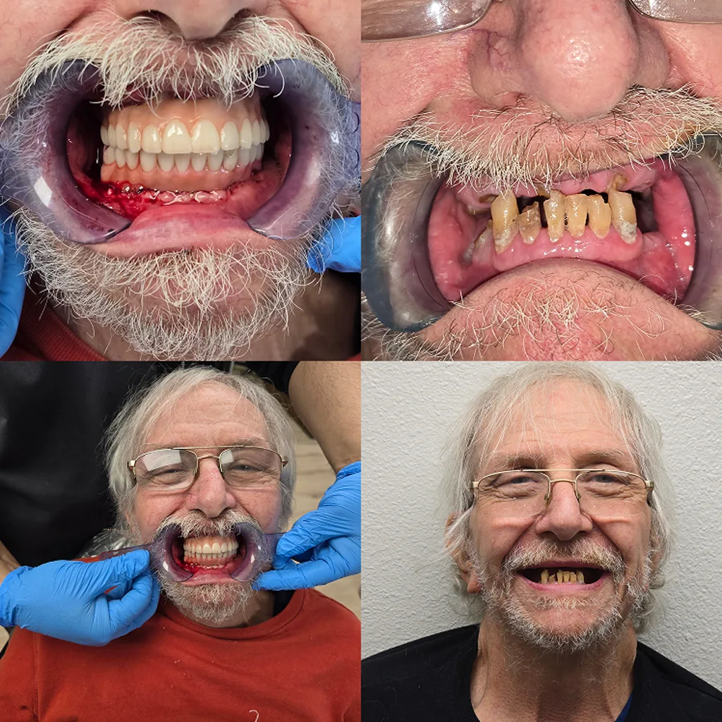 before-after-image-two