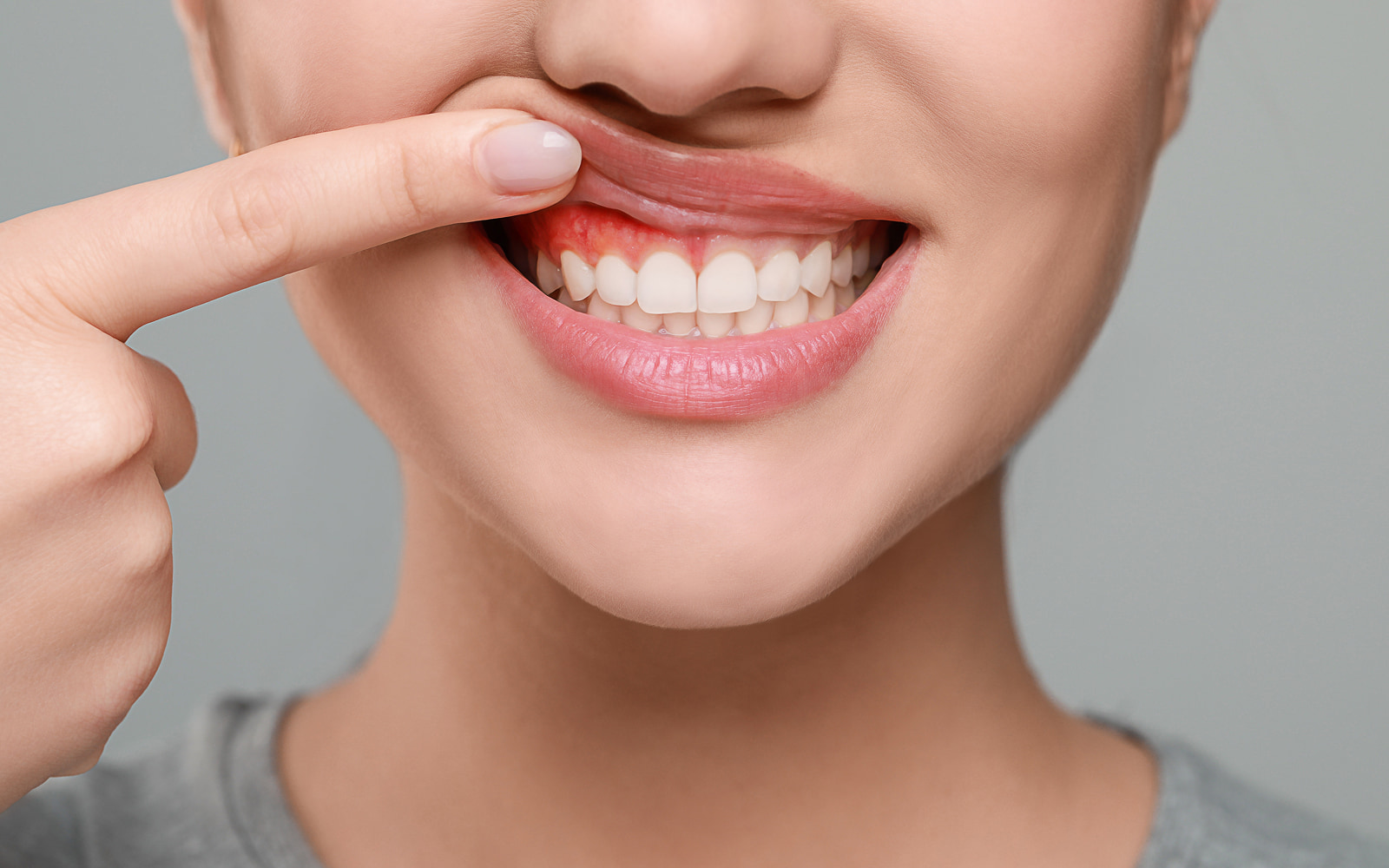 Gum Disease Treatment