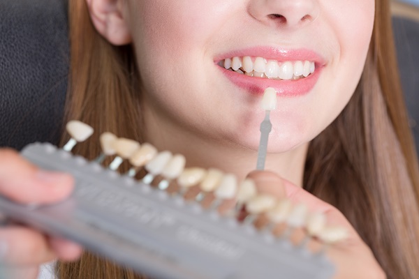 How Can Veneers Improve My Smile?