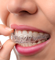 Clear Aligners - Almost Invisible Braces San Antonio, TX